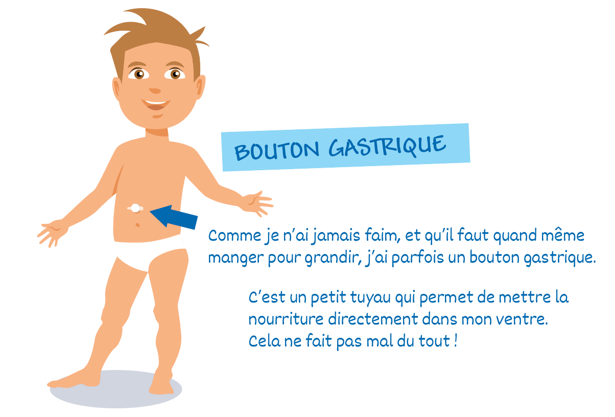 illustration bouton gastrique