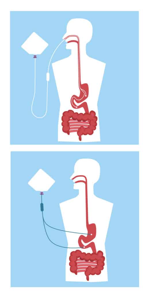 mode d'emploi_sondes gastro intestinales